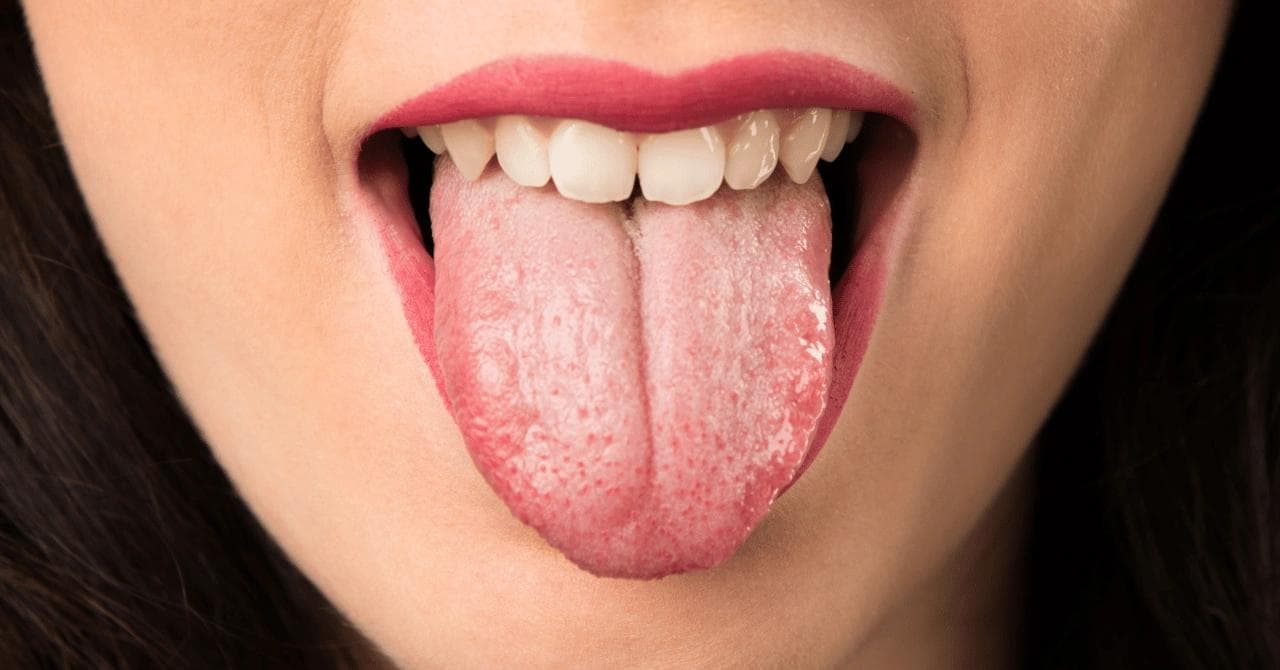 How Semaglutide Triggers Dehydration and Oral Dryness