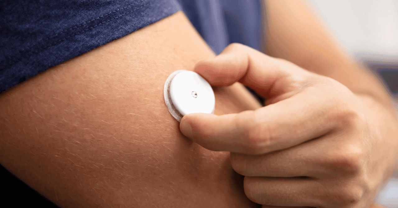 What Are the Different Types of Diabetes Patches